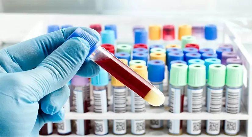 亲子鉴定多长时间出来结果？着急取得结果应当怎么办？