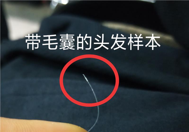 头发可做亲子鉴定吗？这种鉴定方法难度高吗？