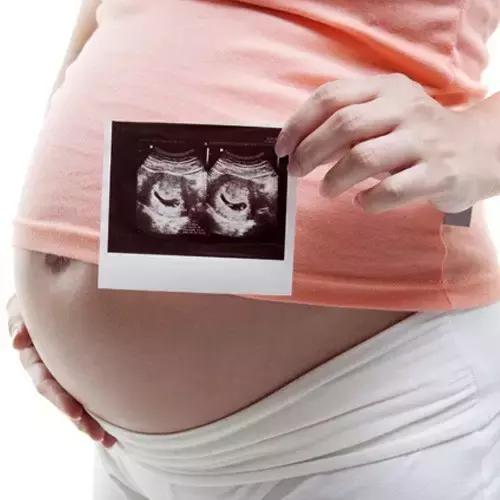 一个多月的胚胎可以做亲子吗?做亲子鉴定应当注意什么?