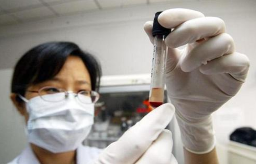 剪下的头发能做亲子鉴定吗？费用是多少？